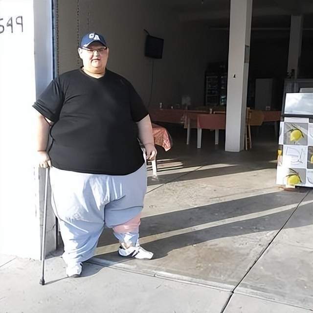 全球最胖男子离世！得年41岁曾达590公斤