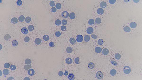 医生警告:身上这4处经常疼痛 可能是癌症信号 医生警告:身上这4处经常疼痛 可能是癌症信号