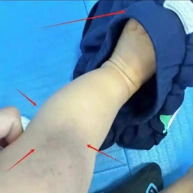 别买这种“加绒裤”！央视曝光，真的有毒