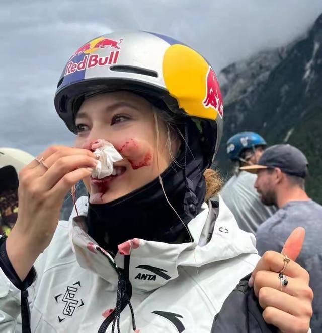 �Ȱ����Գ�Ѫ��ɥ�����ݿ�5���Ӱ����