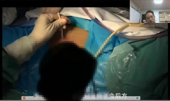 ����ҽԺ����ֱ�����뱩¶Ů���ߣ��鷳��