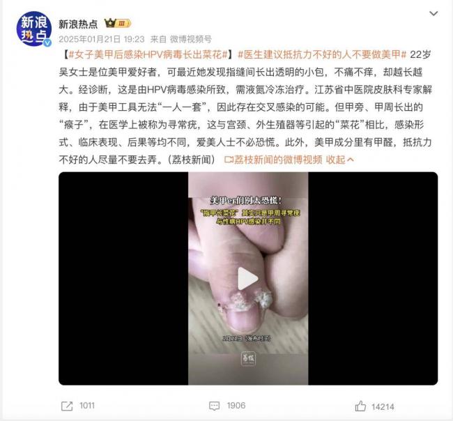 做一次美甲，身体可能承受这些伤害
