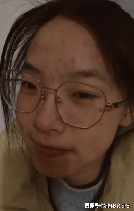 ���Ů������Ƶ������ȫ�Ǳ��ҳ������ĺۼ�