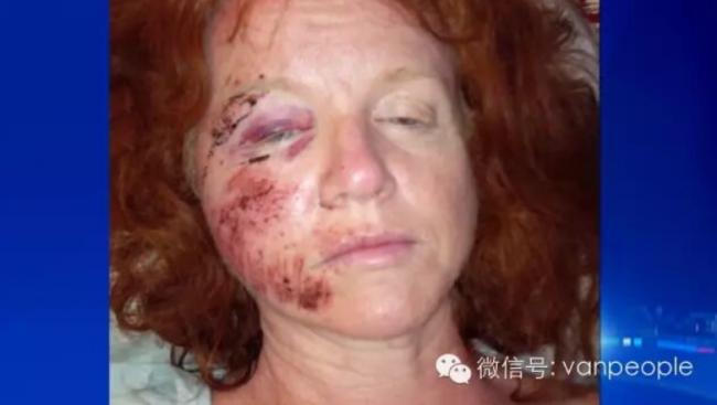 �����е�ս���� ���ô�����ײе�ʱ����