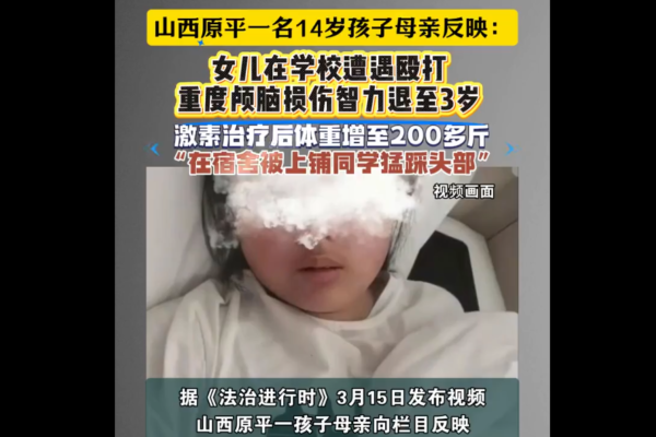 14岁女生疑遭狠踩头部致颅脑重伤 官方通报遭轰