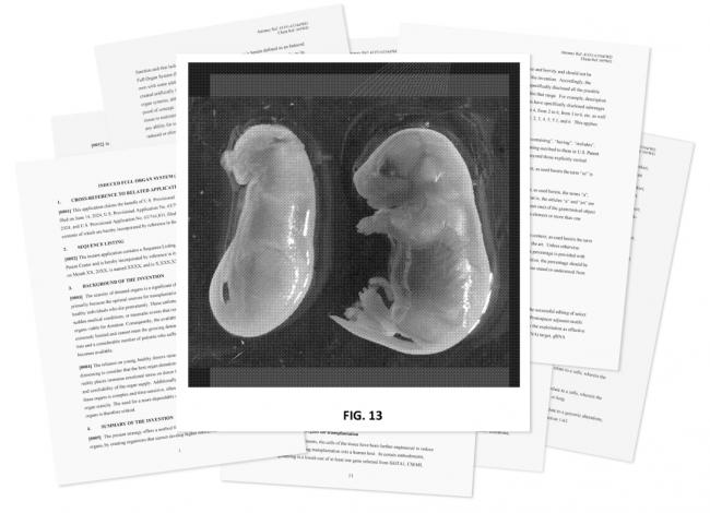 最恐怖的长生项目,正让全球富豪疯砸几十亿 最恐怖的长生项目,正让全球富豪疯砸几十亿