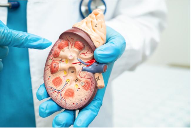 1保健品当水喝 半年后肾脏变采石场