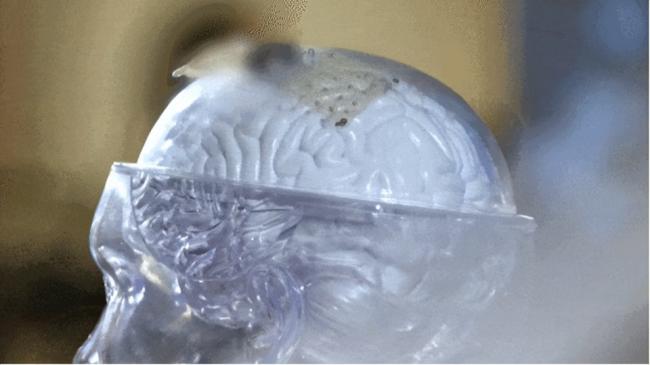 脑机接口,让一些瘫痪患者站起来了 脑机接口,让一些瘫痪患者站起来了