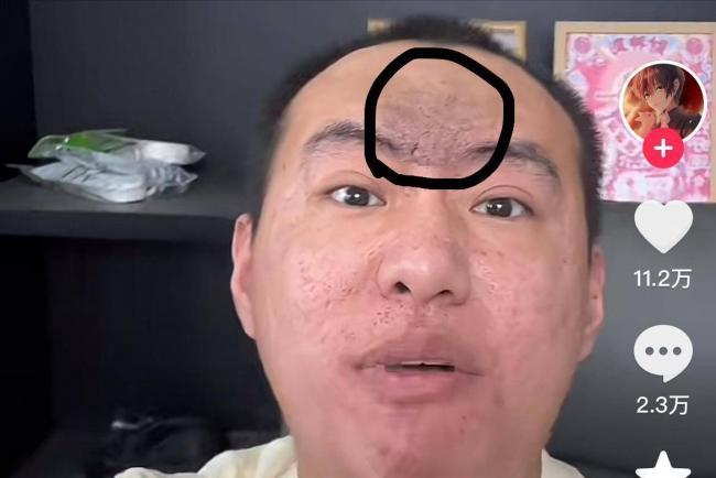 被称“全网八字最硬的男人”,如今他的面相大变 被称“全网八字最硬的男人”,如今他的面相大变