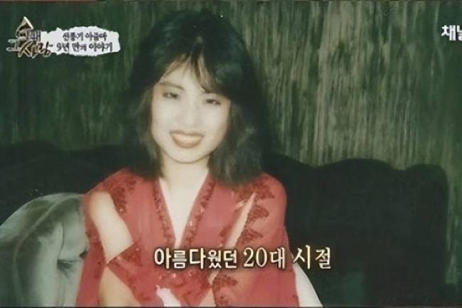 女星整容下狠手 头部取出一公斤液体物质