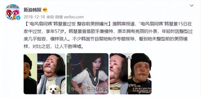 女星整容下狠手 头部取出一公斤液体物质