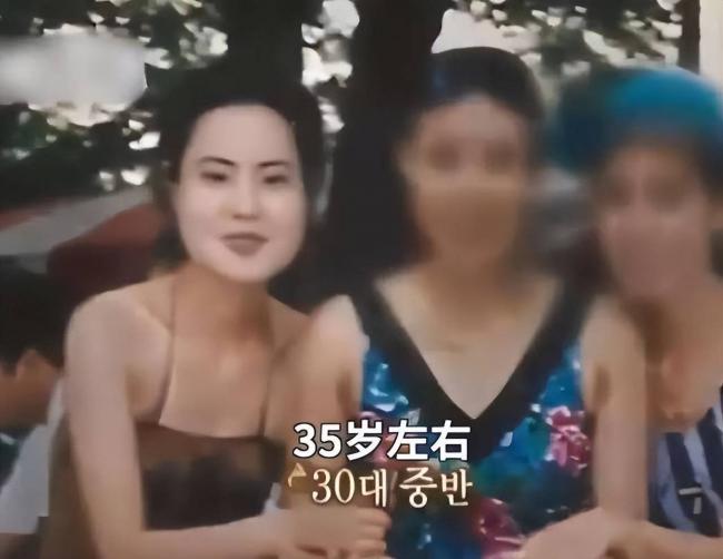 女星整容下狠手 头部取出一公斤液体物质