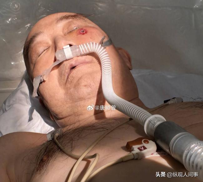 唐师曾多张病房照被公开 催人泪下