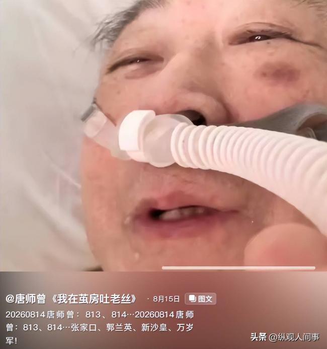 唐师曾多张病房照被公开 催人泪下 唐师曾多张病房照被公开 催人泪下