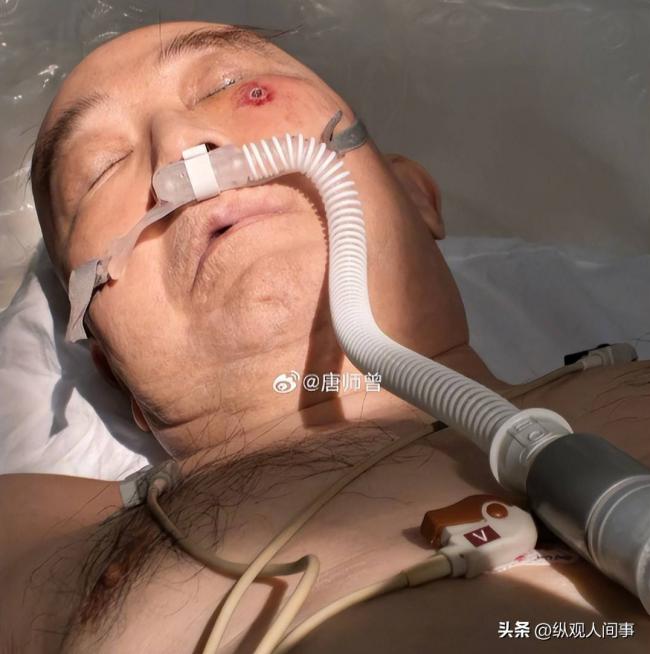 唐师曾多张病房照被公开 催人泪下 唐师曾多张病房照被公开 催人泪下
