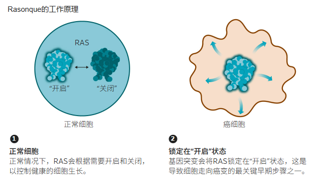 FDA批准新药,胰腺癌治疗迎来里程碑 FDA批准新药,胰腺癌治疗迎来里程碑