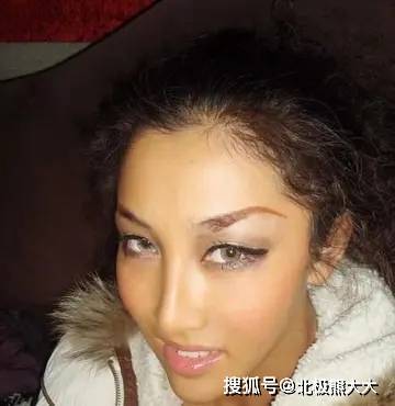 中国歌手被黑人男友暴打至肛裂，现状被曝