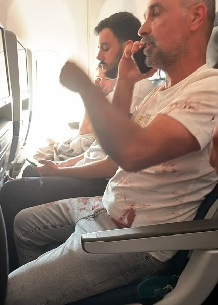 “驾驶员浑身是血” 迪拜航空劫机事件照片流出 “驾驶员浑身是血” 迪拜航空劫机事件照片流出