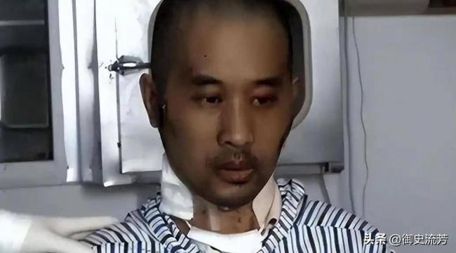 武汉首批新冠重症幸存者,6年后现状如何 武汉首批新冠重症幸存者,6年后现状如何