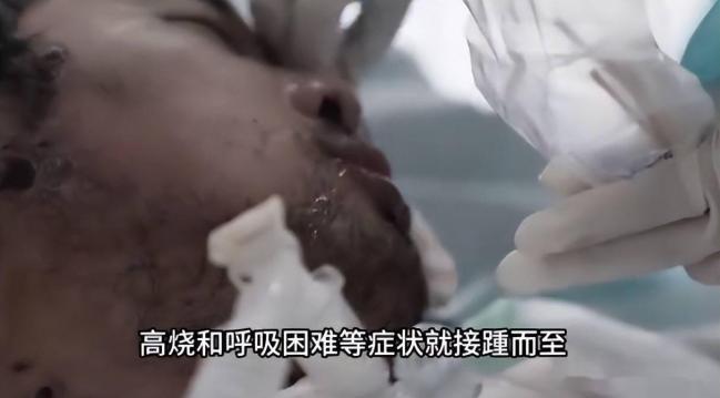 武汉首批新冠重症幸存者,6年后现状如何 武汉首批新冠重症幸存者,6年后现状如何
