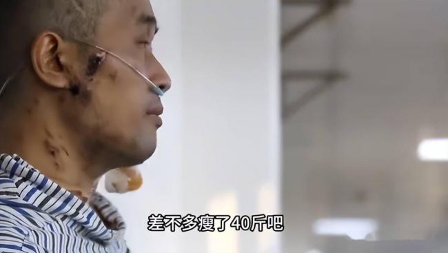 武汉首批新冠重症幸存者,6年后现状如何 武汉首批新冠重症幸存者,6年后现状如何