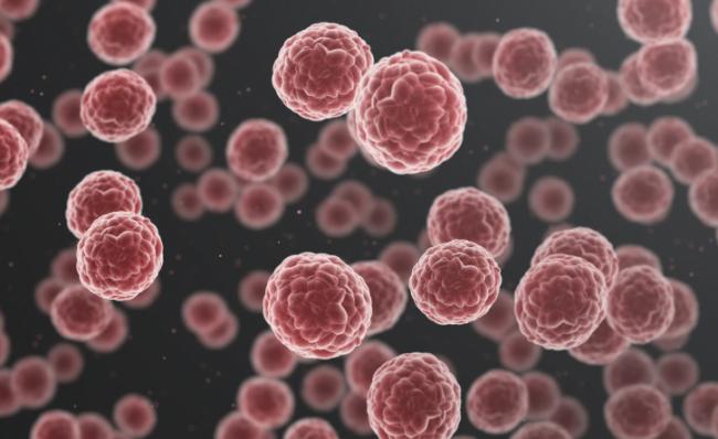 中国人发病率最高的5种癌症 其中一个越来越多