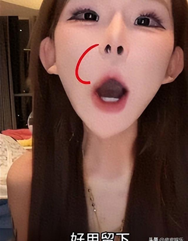 能被自己臭醒...中国网红分享整容后遗症