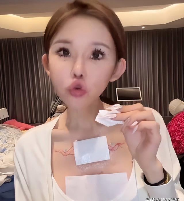 能被自己臭醒...中国网红分享整容后遗症