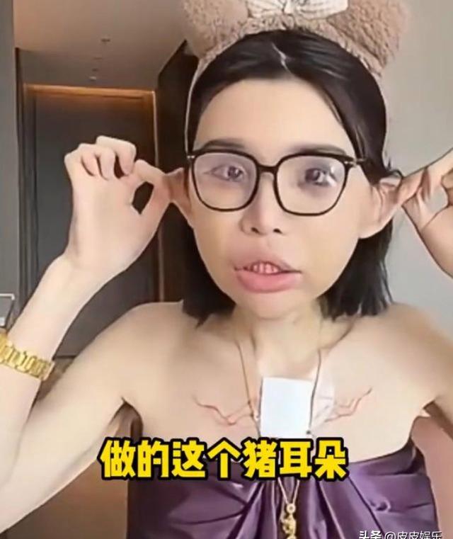 能被自己臭醒...中国网红分享整容后遗症